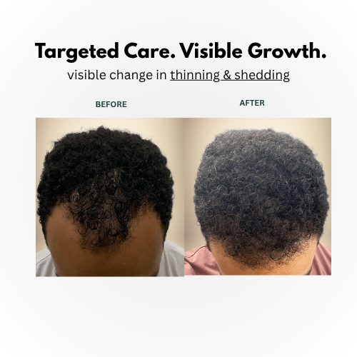 SilkyGrow™ Roll-On Serum