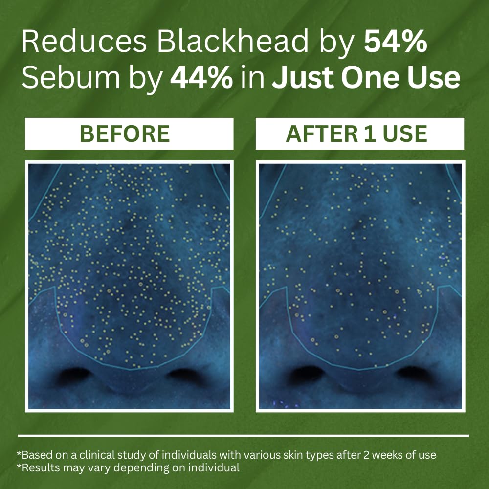 HeSilky™ Holy Basil Bubble Deep Mask